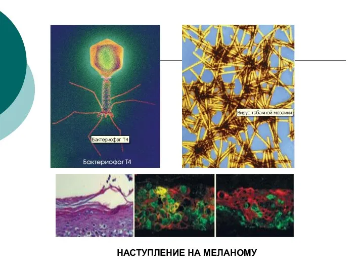 НАСТУПЛЕНИЕ НА МЕЛАНОМУ