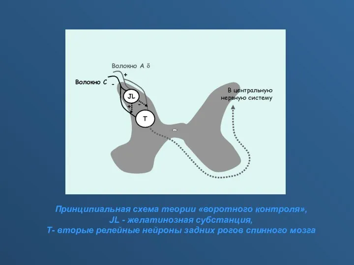 Принципиальная схема теории «воротного контроля», JL - желатинозная субстанция, Т- вторые