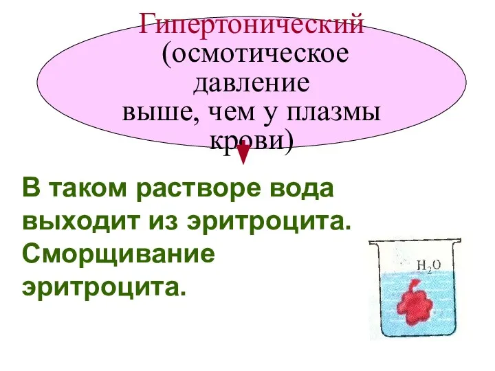 Гипертонический (осмотическое давление выше, чем у плазмы крови) В таком растворе