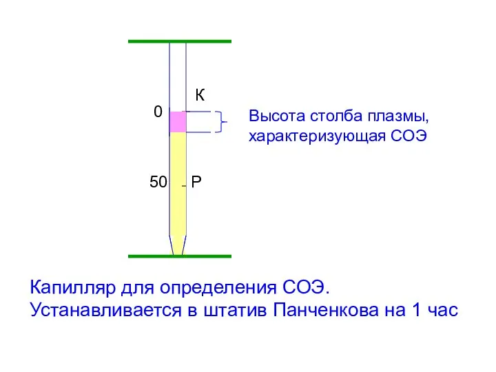 50 Р 0 К Высота столба плазмы, характеризующая СОЭ Капилляр для