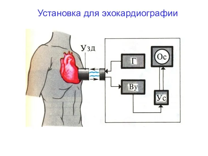 Установка для эхокардиографии