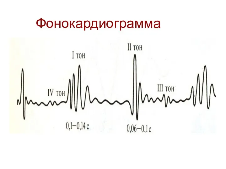 Фонокардиограмма