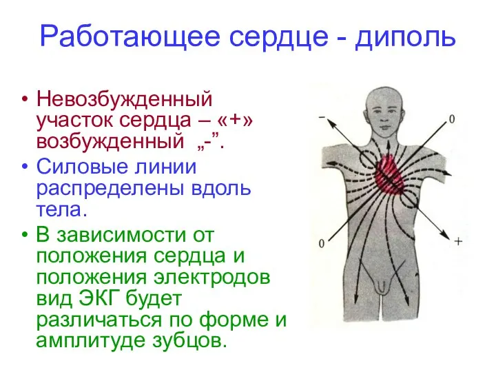 Работающее сердце - диполь Невозбужденный участок сердца – «+» возбужденный „-”.