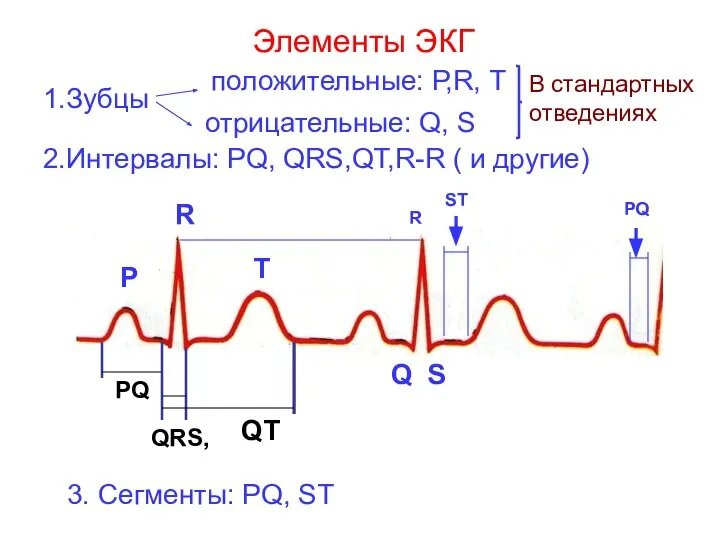 Элементы ЭКГ 1.Зубцы положительные: Р,R, Т отрицательные: Q, S В стандартных