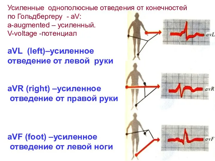 Усиленные однополюсные отведения от конечностей по Гольдбергеру - aV: a-augmented –