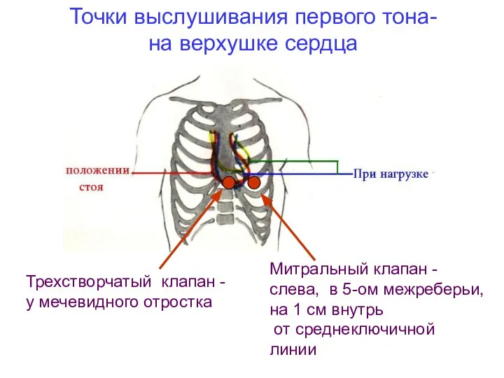 Точки выслушивания первого тона- на верхушке сердца Митральный клапан - слева,