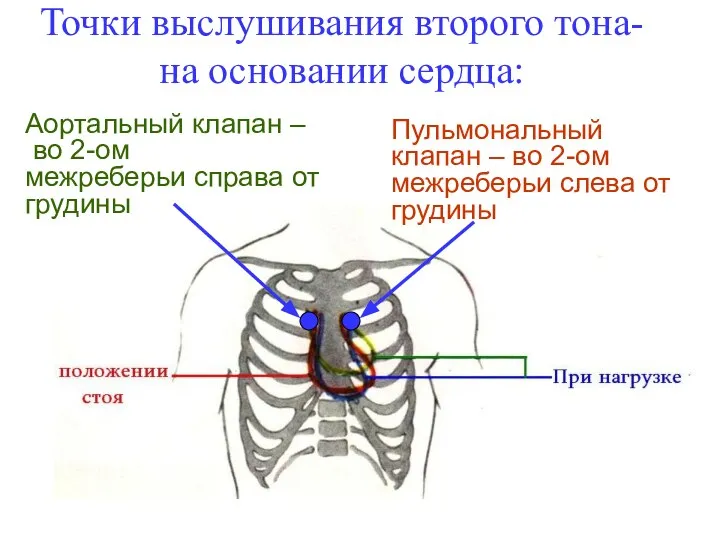Точки выслушивания второго тона- на основании сердца: Аортальный клапан – во