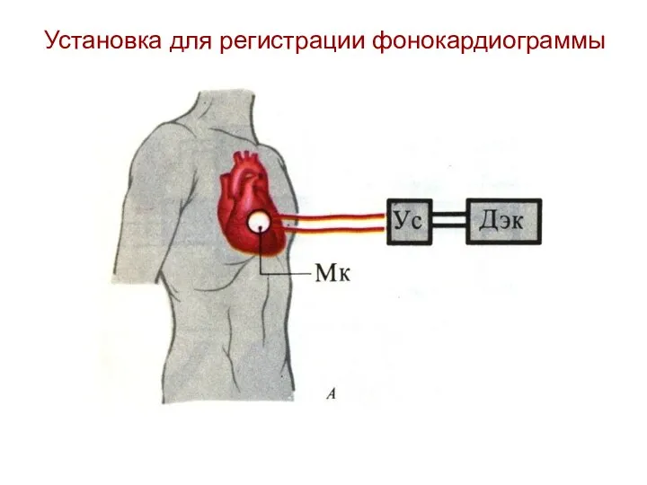 Установка для регистрации фонокардиограммы