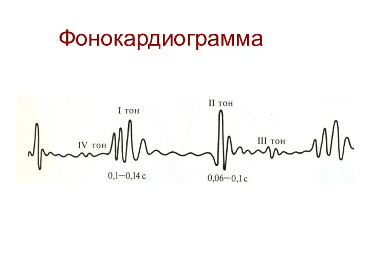 Фонокардиограмма