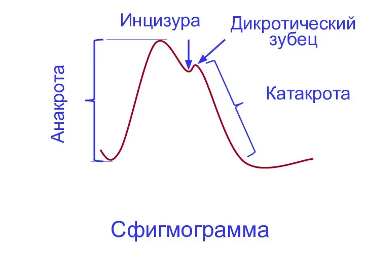 Сфигмограмма Анакрота Инцизура Дикротический зубец Катакрота