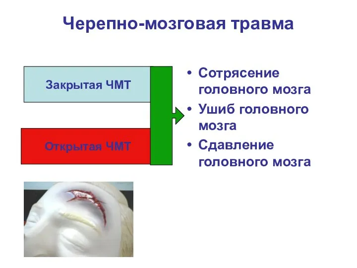 Черепно-мозговая травма Сотрясение головного мозга Ушиб головного мозга Сдавление головного мозга Закрытая ЧМТ Открытая ЧМТ