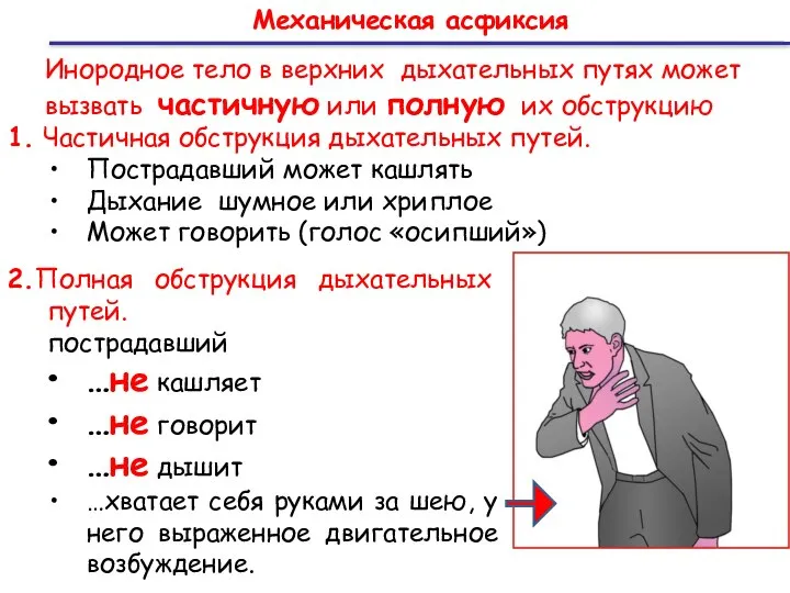 Механическая асфиксия Инородное тело в верхних дыхательных путях может вызвать частичную