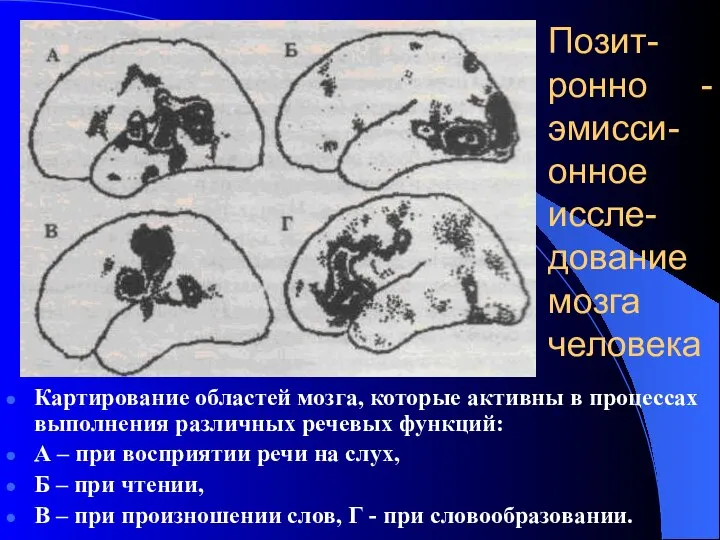 Позит- ронно - эмисси- онное иссле- дование мозга человека Картирование областей