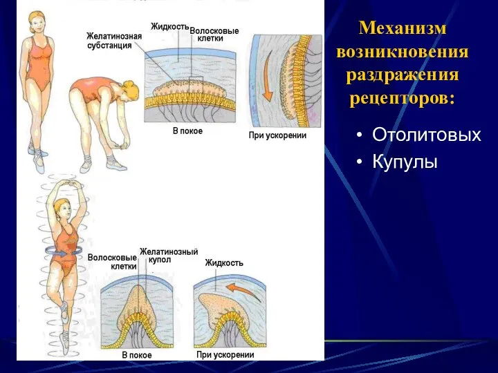 Механизм возникновения раздражения рецепторов: Отолитовых Купулы