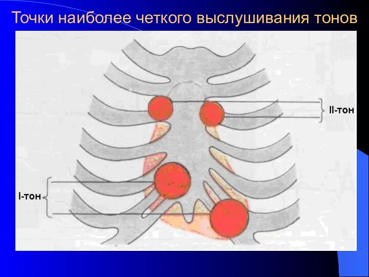 Точки наиболее четкого выслушивания тонов