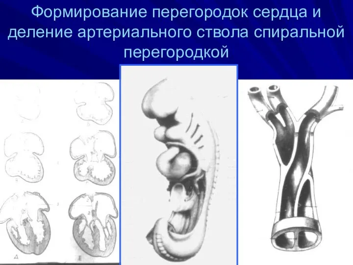 Формирование перегородок сердца и деление артериального ствола спиральной перегородкой