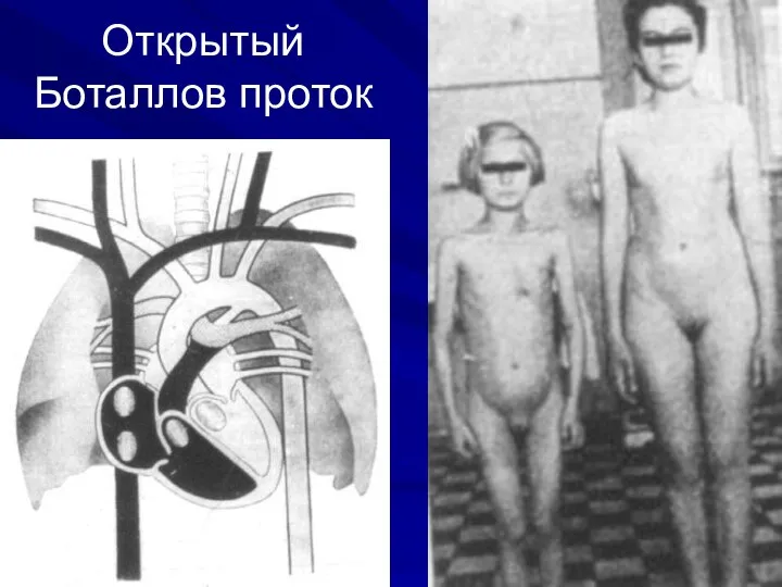 Открытый Боталлов проток