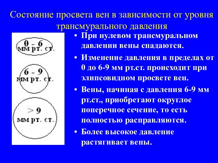 Состояние просвета вен в зависимости от уровня трансмурального давления При нулевом