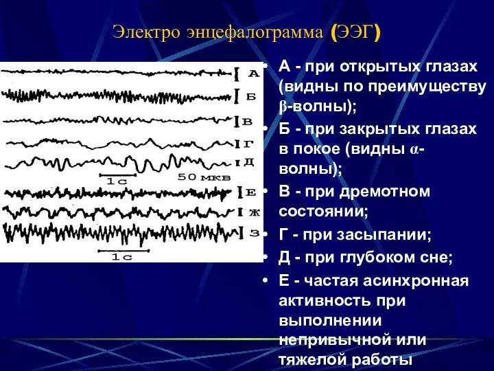 Электро энцефалограмма (ЭЭГ) А - при открытых глазах (видны по преимуществу