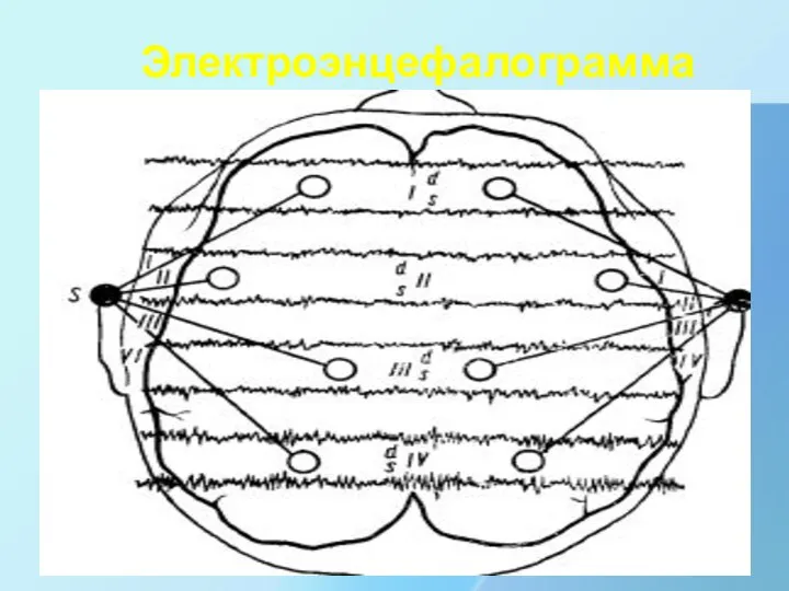 Электроэнцефалограмма