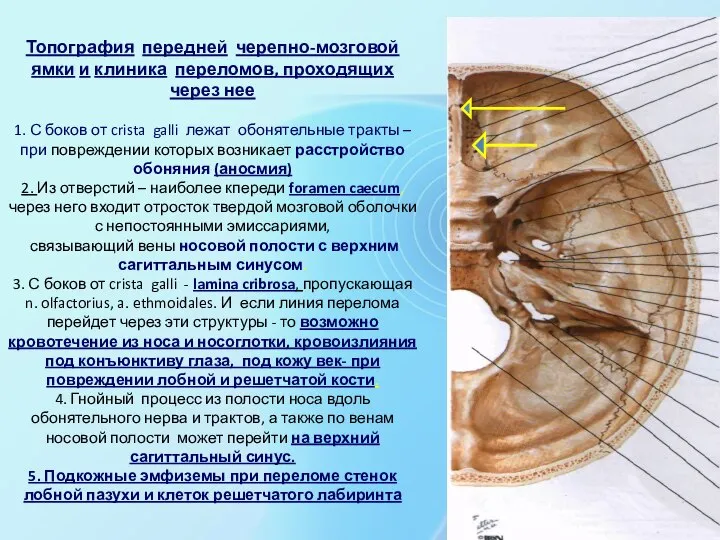 Топография передней черепно-мозговой ямки и клиника переломов, проходящих через нее 1.