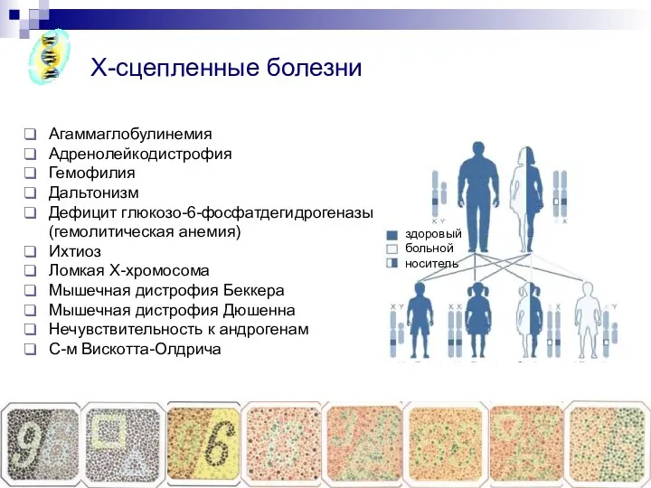 Copyright L. Gerasimova 2007 Агаммаглобулинемия Адренолейкодистрофия Гемофилия Дальтонизм Дефицит глюкозо-6-фосфатдегидрогеназы (гемолитическая