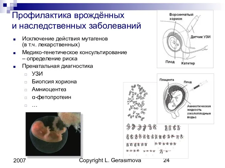 Copyright L. Gerasimova 2007 Профилактика врождённых и наследственных заболеваний Исключение действия