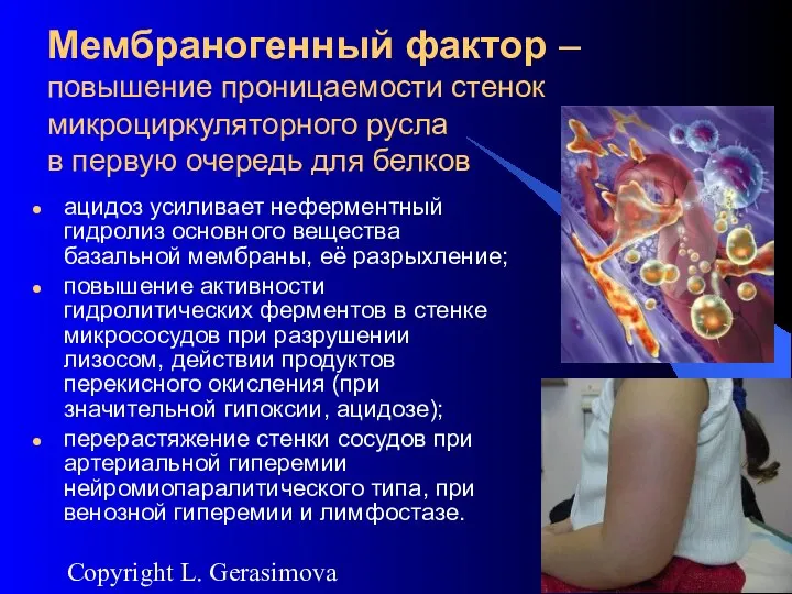 2007 Copyright L. Gerasimova Мембраногенный фактор – повышение проницаемости стенок микроциркуляторного