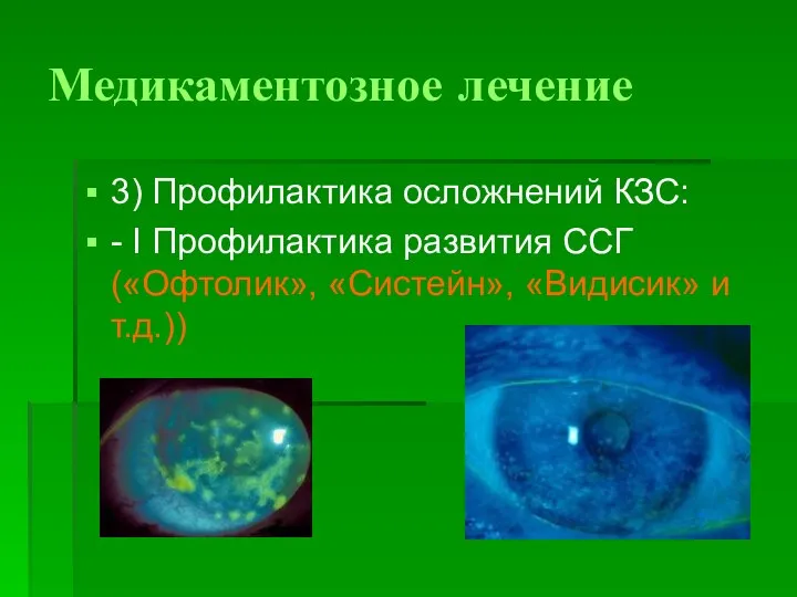 Медикаментозное лечение 3) Профилактика осложнений КЗС: - I Профилактика развития ССГ («Офтолик», «Систейн», «Видисик» и т.д.))