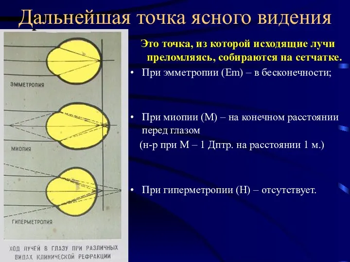 Дальнейшая точка ясного видения Это точка, из которой исходящие лучи преломляясь,