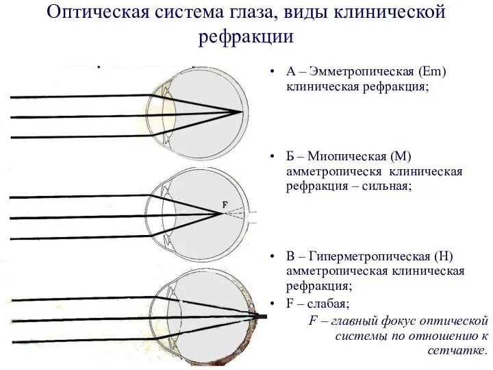 Оптическая система глаза, виды клинической рефракции А – Эмметропическая (Em) клиническая