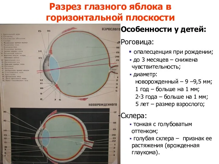 Разрез глазного яблока в горизонтальной плоскости Особенности у детей: Роговица: опалесценция