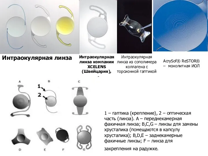 Интраокулярная линза компании XCELENS (Швейцария), Интраокулярная линза из сополимера коллагена с