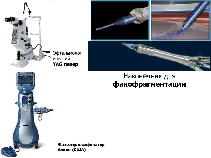 Факоэмульсификатор Алкон (США) Наконечник для факофрагментации Офтальмологический YAG лазер