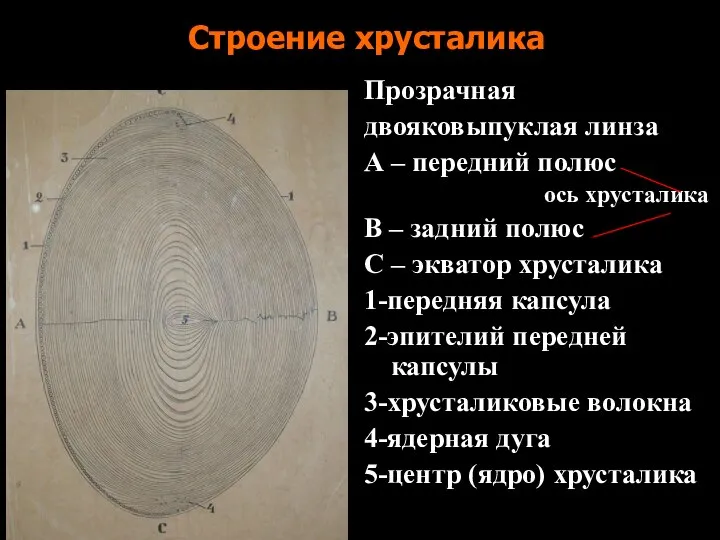 Строение хрусталика Прозрачная двояковыпуклая линза А – передний полюс ось хрусталика