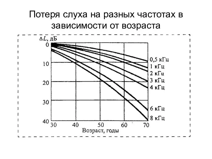 Потеря слуха на разных частотах в зависимости от возраста