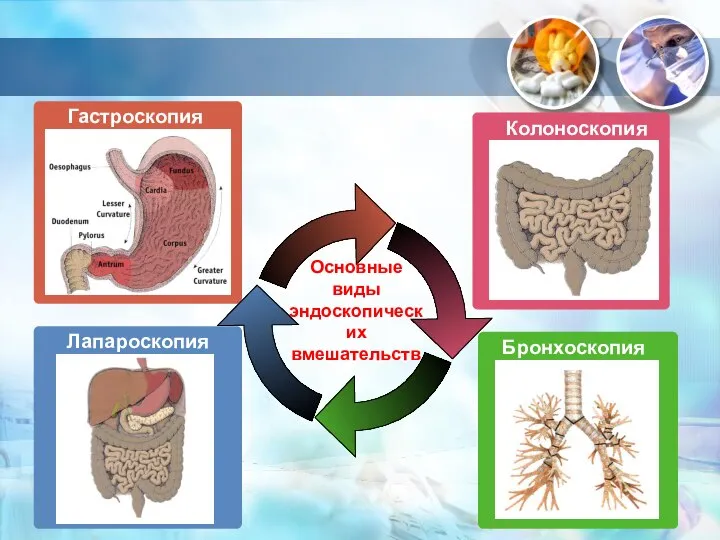 Лапароскопия Гастроскопия Бронхоскопия Колоноскопия Основные виды эндоскопических вмешательств