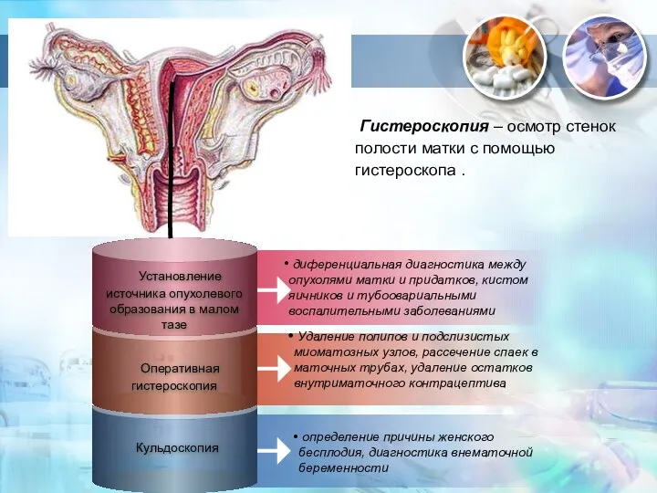 диференциальная диагностика между опухолями матки и придатков, кистом яичников и тубоовариальными