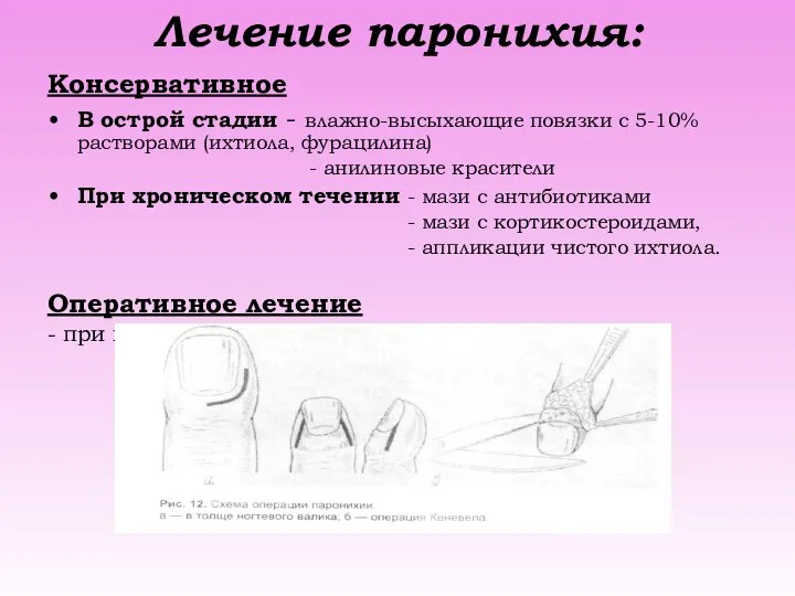 Лечение паронихия: Консервативное В острой стадии - влажно-высыхающие повязки с 5-10%