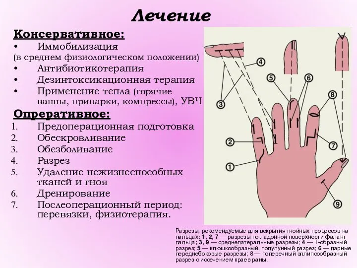 Лечение Консервативное: Иммобилизация (в среднем физиологическом положении) Антибиотикотерапия Дезинтоксикационная терапия Применение