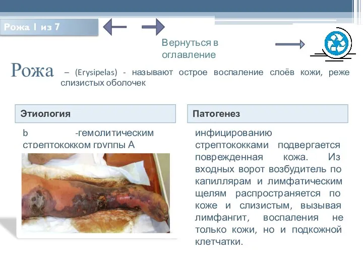 Рожа Этиология Патогенез b -гемолитическим стрептококком группы А инфицированию стрептококками подвергается