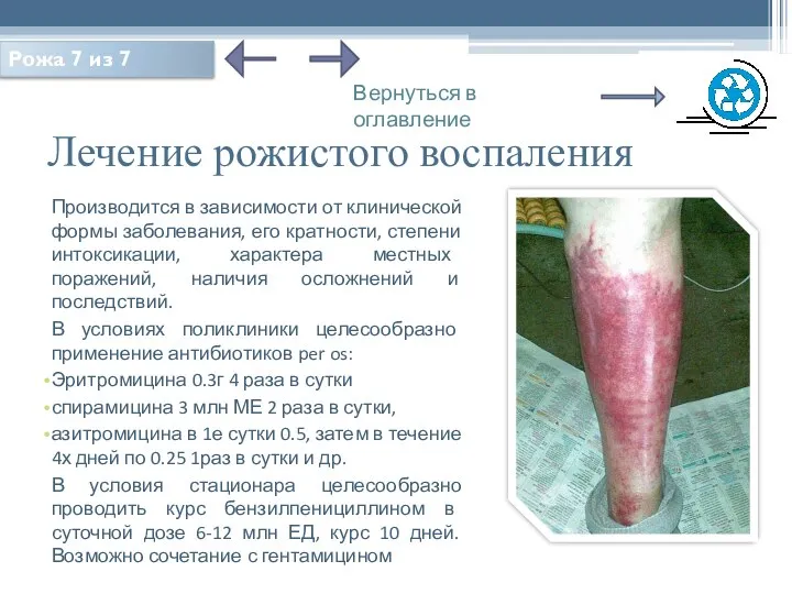 Лечение рожистого воспаления Производится в зависимости от клинической формы заболевания, его