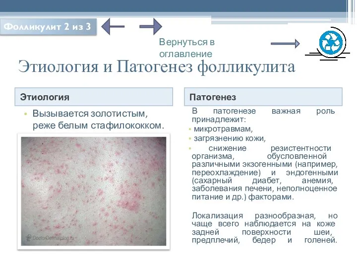 Этиология и Патогенез фолликулита Этиология Патогенез Вызывается золотистым, реже белым стафилококком.