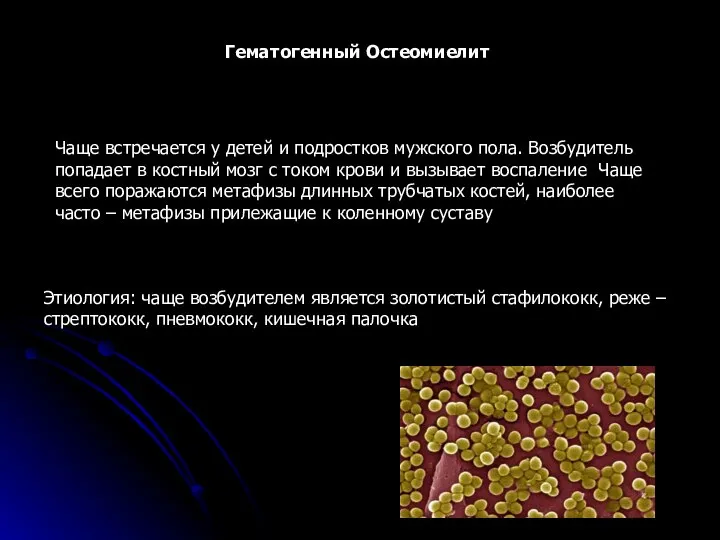 Гематогенный Остеомиелит Этиология: чаще возбудителем является золотистый стафилококк, реже –стрептококк, пневмококк,