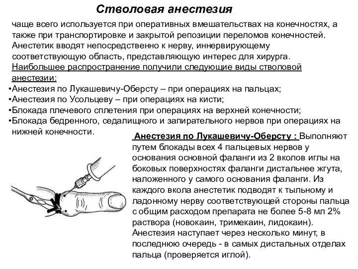 чаще всего используется при оперативных вмешательствах на конечностях, а также при