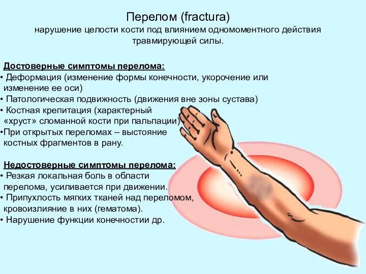 Достоверные симптомы перелома: Деформация (изменение формы конечности, укорочение или изменение ее