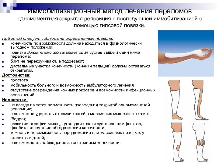 При этом следует соблюдать определенные правила: конечность по возможности должна находиться