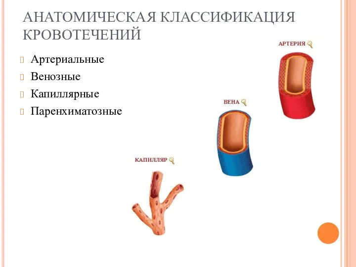 АНАТОМИЧЕСКАЯ КЛАССИФИКАЦИЯ КРОВОТЕЧЕНИЙ Артериальные Венозные Капиллярные Паренхиматозные