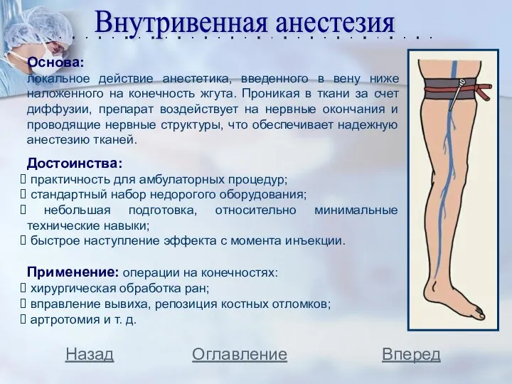 Внутривенная анестезия Основа: локальное действие анестетика, введенного в вену ниже наложенного