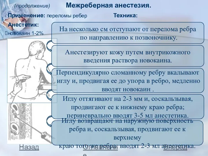 (продолжение) Межреберная анестезия. Назад Вперед Оглавление